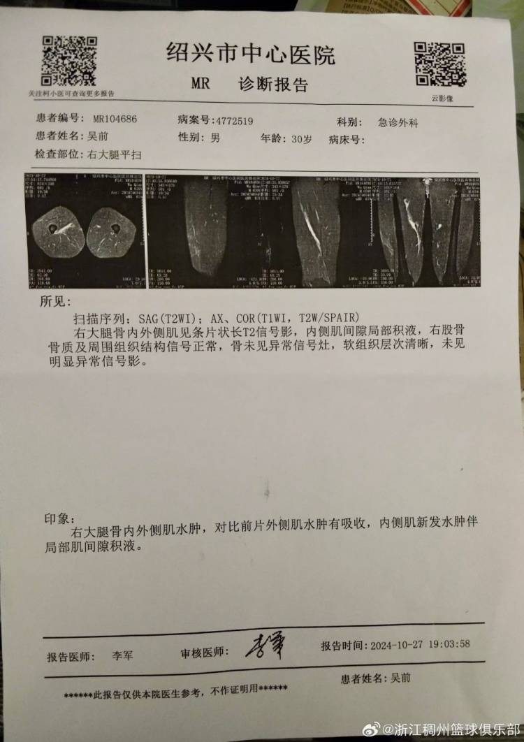 哈里伯顿右小腿拉伤将进行核磁检查G6出战成疑